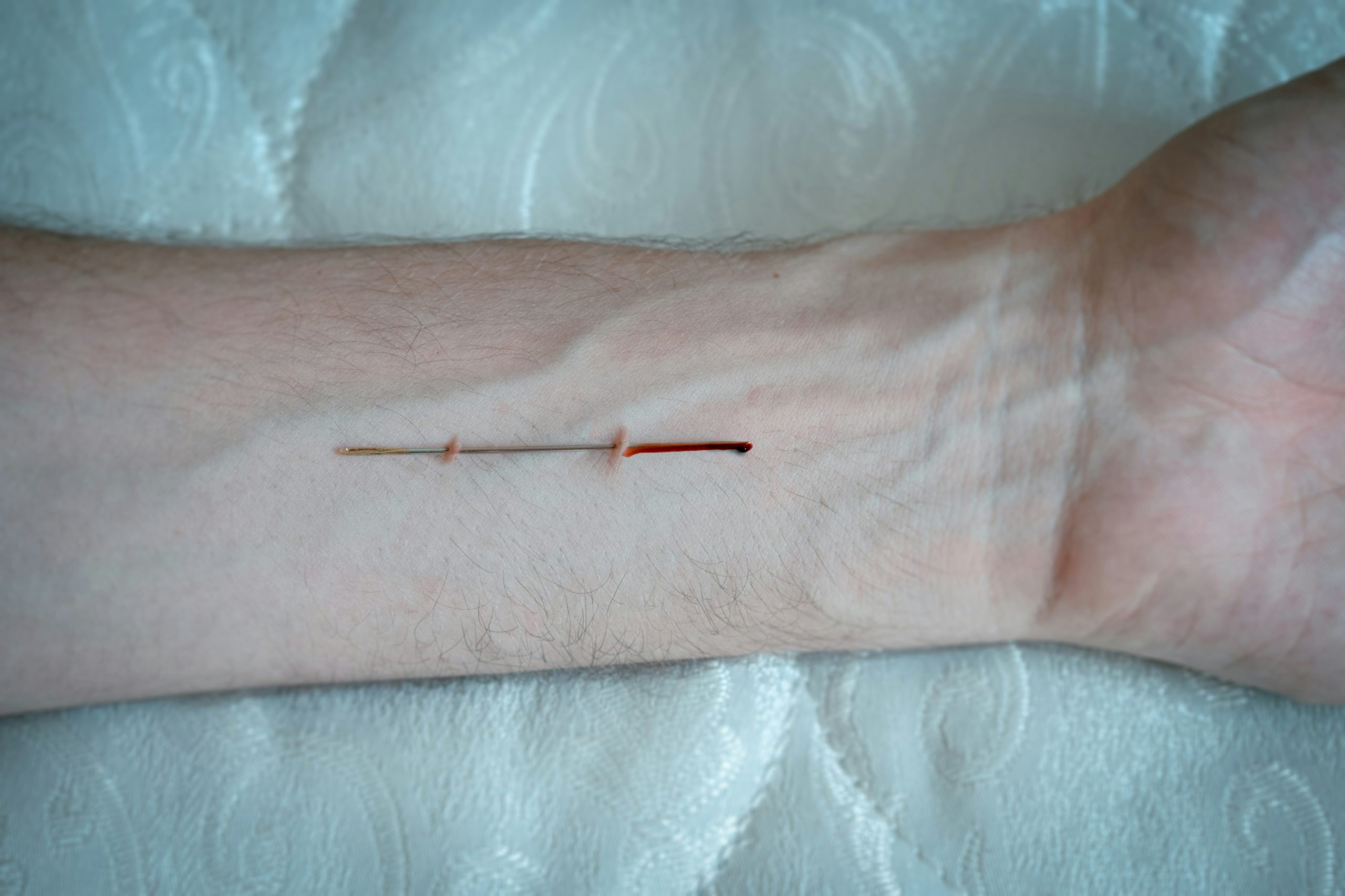 A fresh cut on a person's wrist is visible.